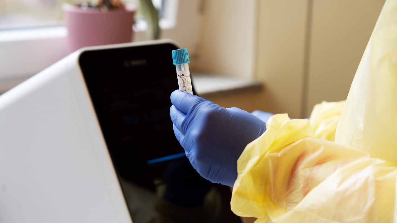 Il test rapido per il coronavirus di Bosch diventa più veloce thumbnail