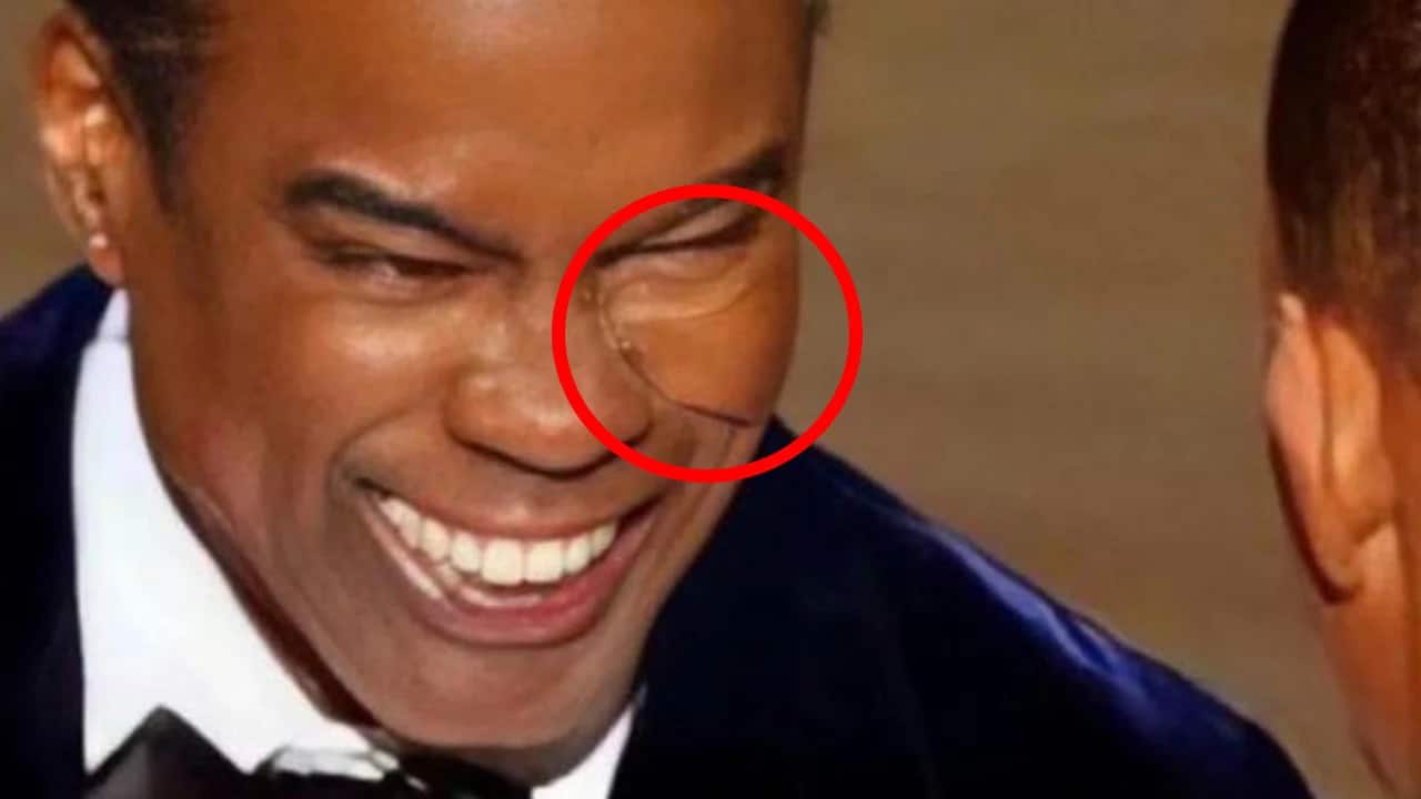 Chris Rock indossava una protezione sulla guancia quando Will Smith lo ha schiaffeggiato? La risposta è no thumbnail
